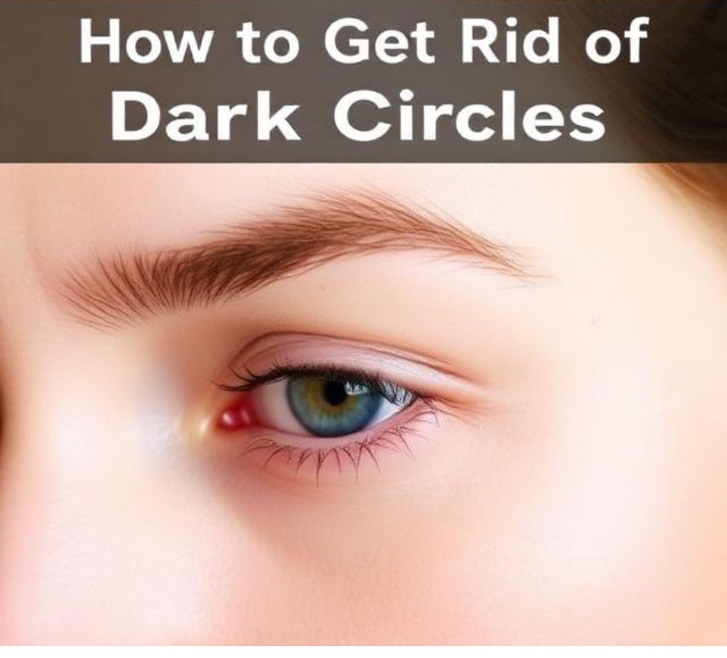 How to Get Rid of Dark Circles Under Eyes
